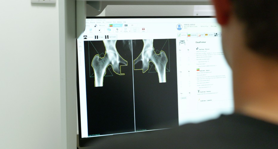 A man examines a computer screen displaying a dxa scan of an x-ray image for analysis.